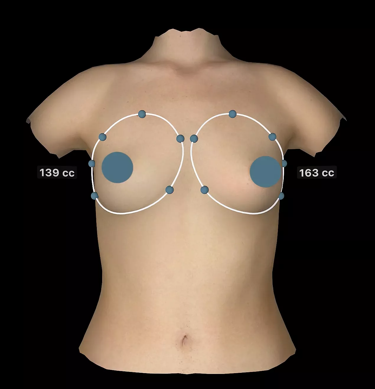 Breast analysis simulation