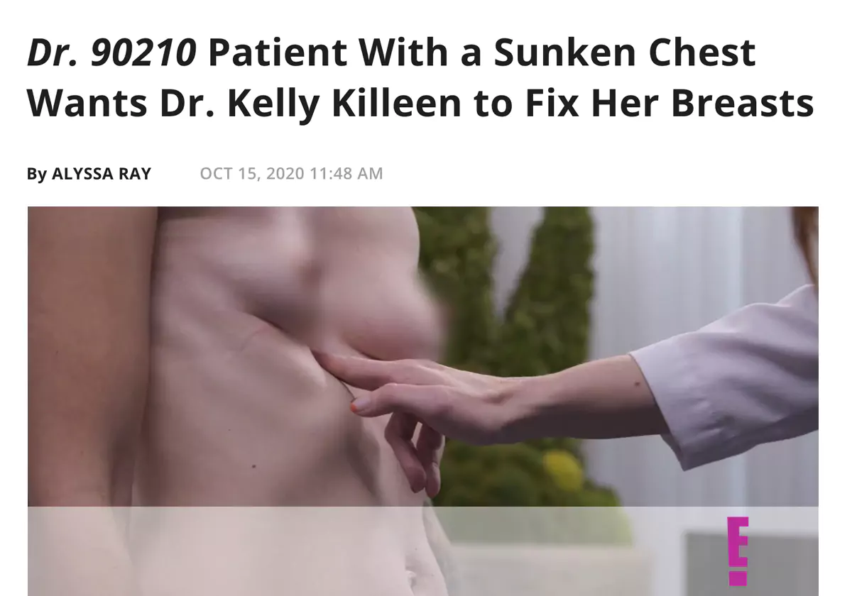 Dr. Kelly Killeen Transforms Size M Breasts in Biggest Reduction