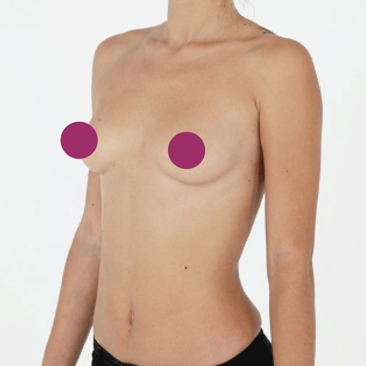Left 45 degree angle photo example